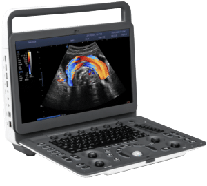 Ultrassom Colorido Doppler E2v