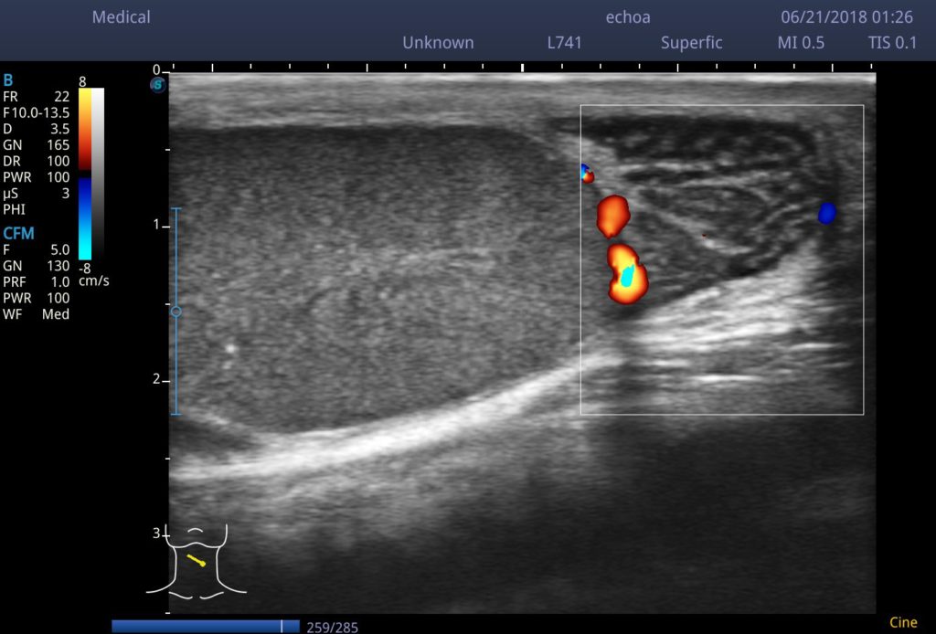 Ultrassom Color Doppler E2v